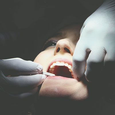 Capacitação Cirúrgico e Protético em Implantes Dentais Osseointegráveis