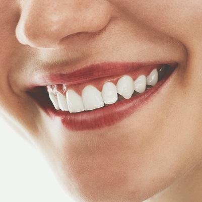 Lapidando a beleza dos dentes naturais através de Resoluções minimamente invasivas: Clareamento, Microabrasão e Infiltrantes.