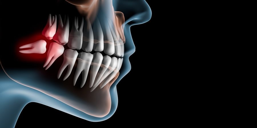 Capacitação em Cirurgia Buco Dentária