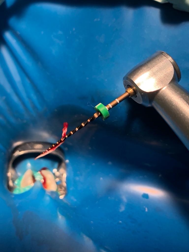 Atualização em Endodontia