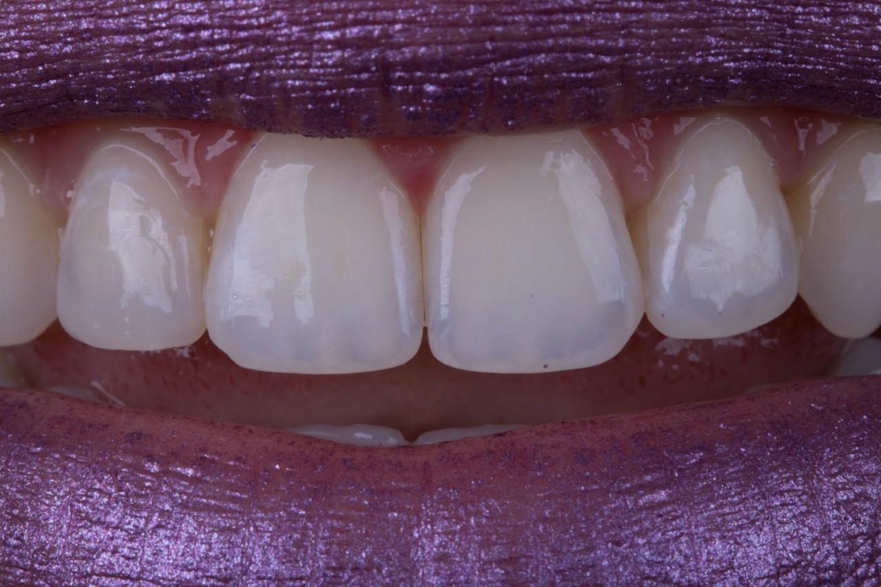 Atualização Master de Tópicos Especiais em Dentística