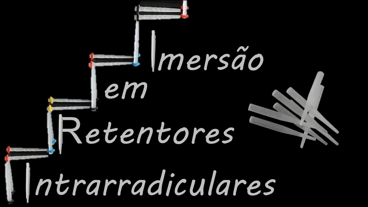 Imersão em Retentores Intrarradiculares de Fibra de Vidro