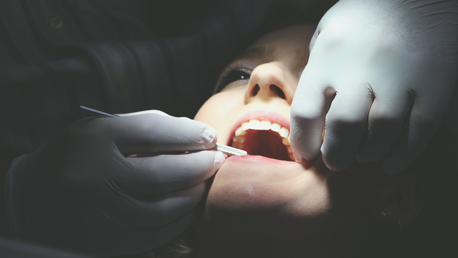 Capacitação Cirúrgico e Protético em Implantes Dentais Osseointegráveis - 2ª turma