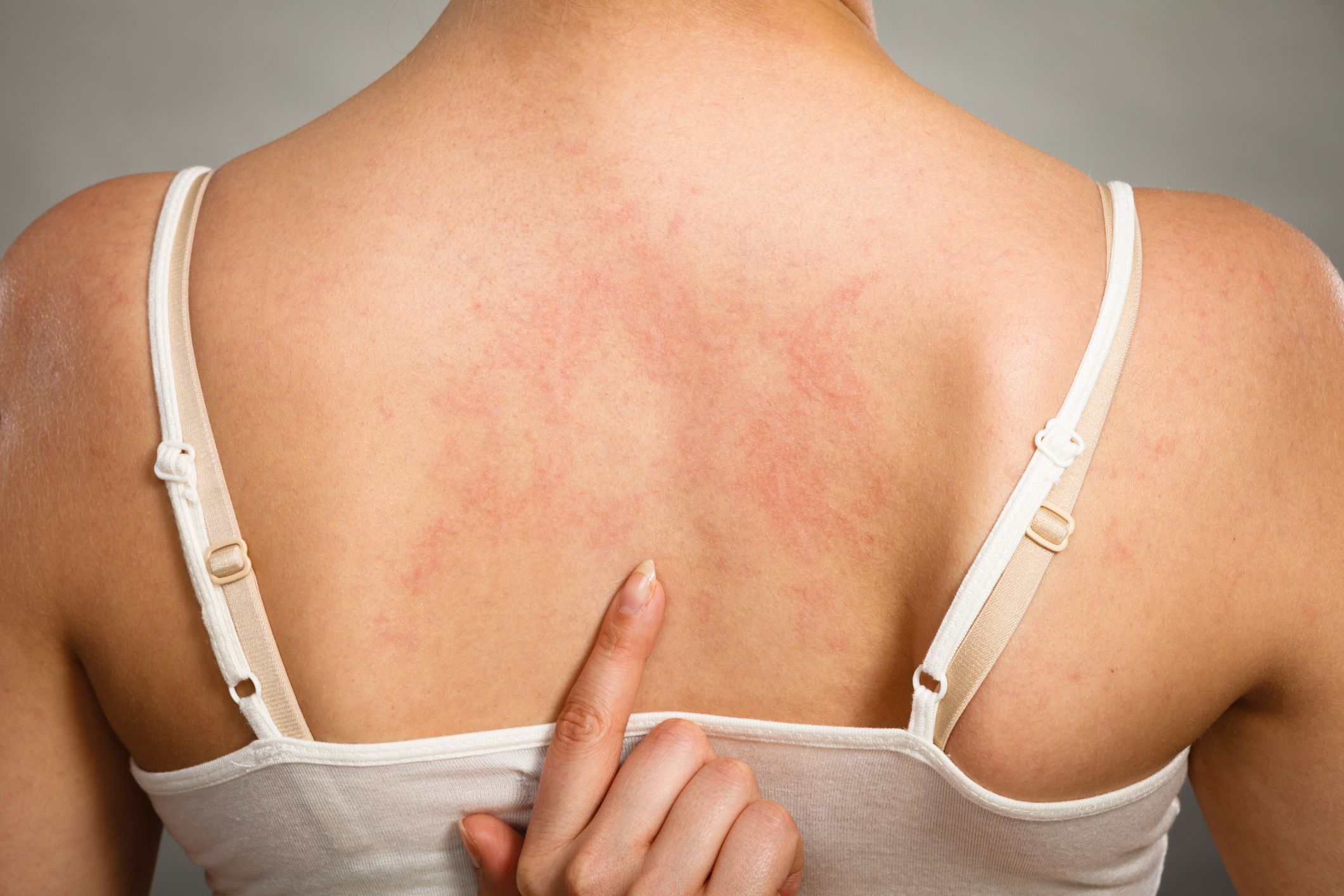 Dermatologia Clínica - Turma 3