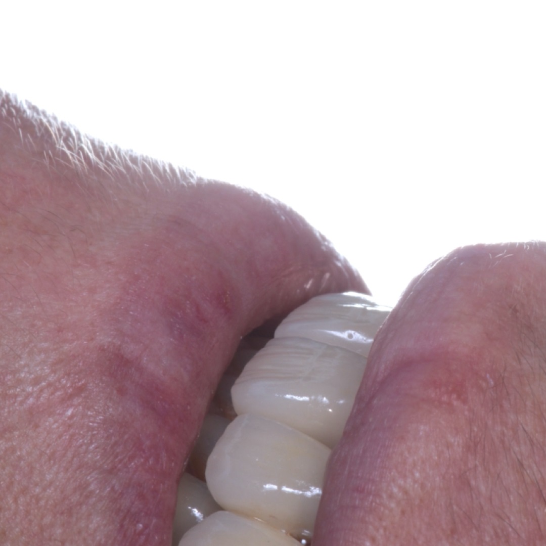 Atualização em reabilitação oral estética e funcional