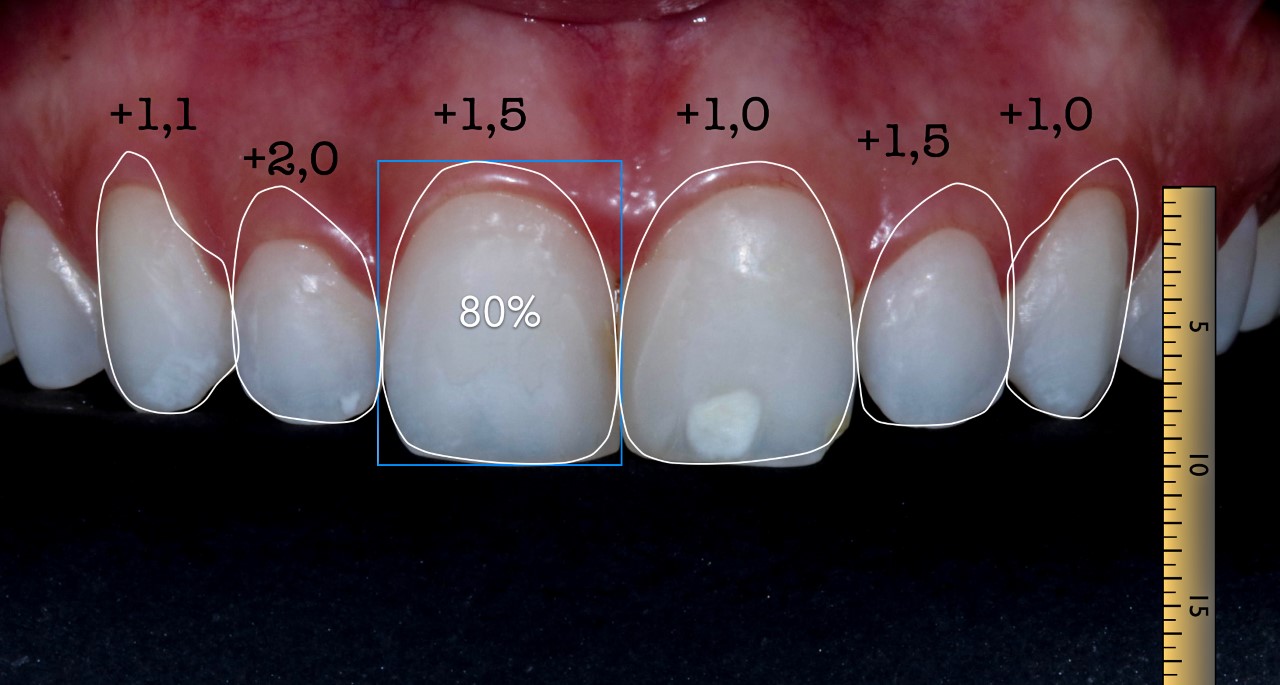 Aplicação de recursos digitais para análise estética e planejamento em Odontologia - 1ª Turma