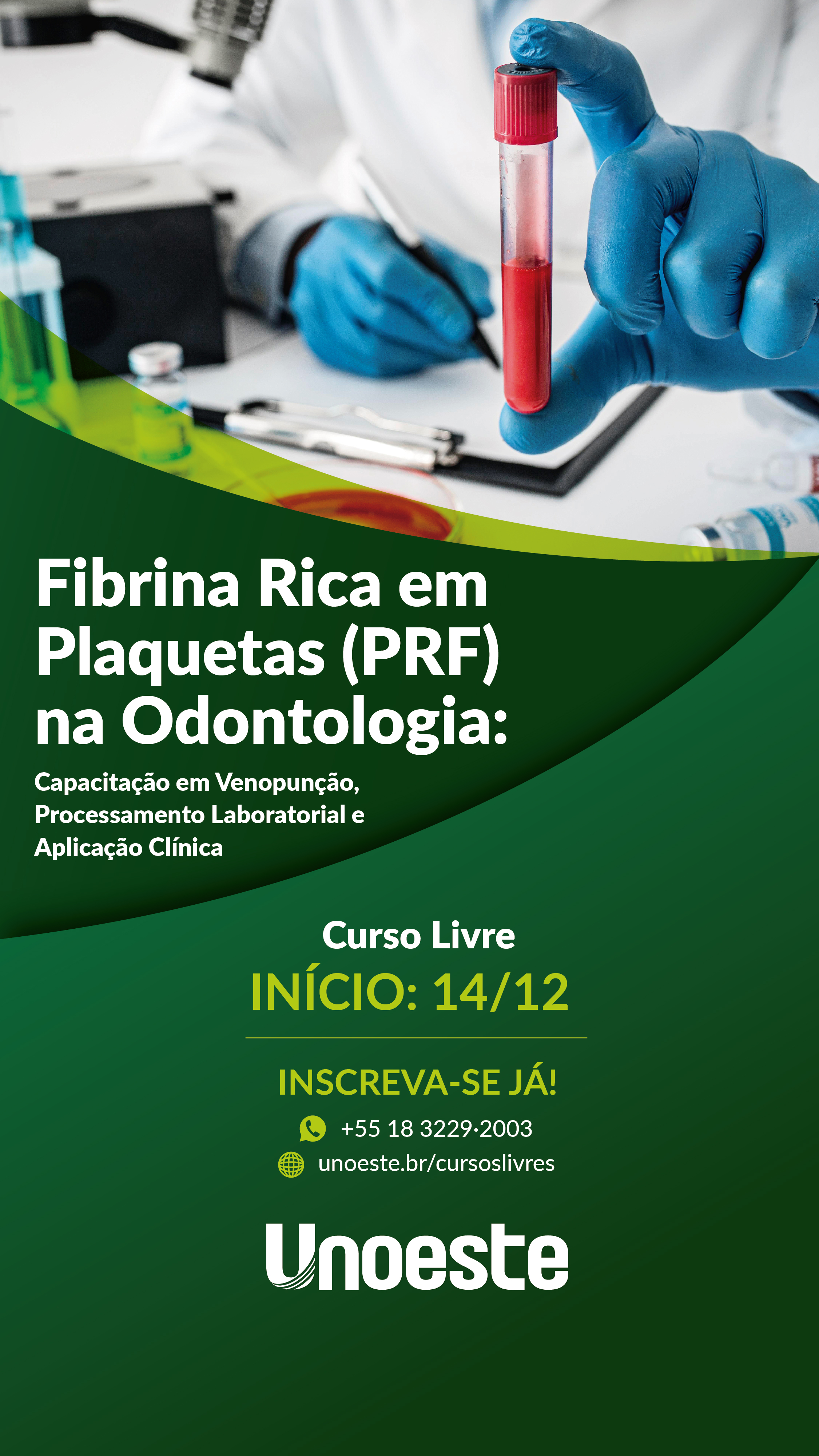 Fibrina Rica em Plaquetas (PRF) na Odontologia: Capacitação em Venopunção, Processamento Laboratorial e Aplicação Clínica