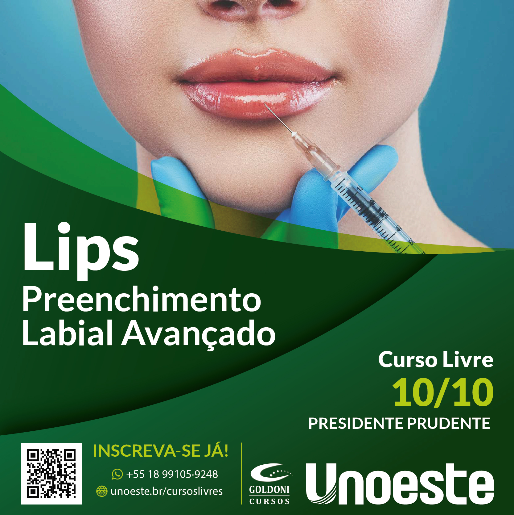Lips: Preenchimento Labial Avançado