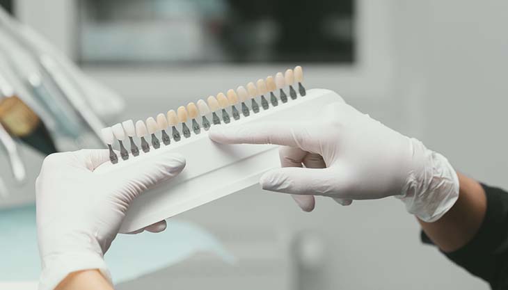 Imersão em resinas compostas para dentes anteriores - 6ª Turma                                                                                                                                                                                                 