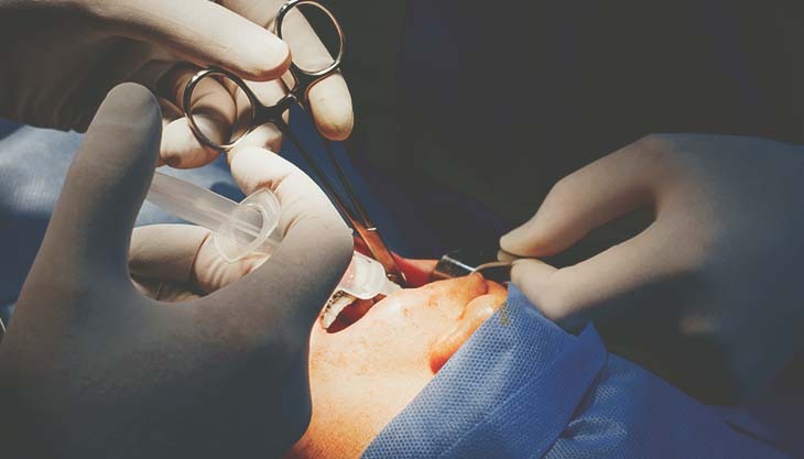 Capacitação em Cirurgia Buco Dentária - 6ª turma                                                                                                                                                                                                               